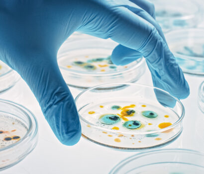 Slowing the Spread of Antimicrobial Resistance