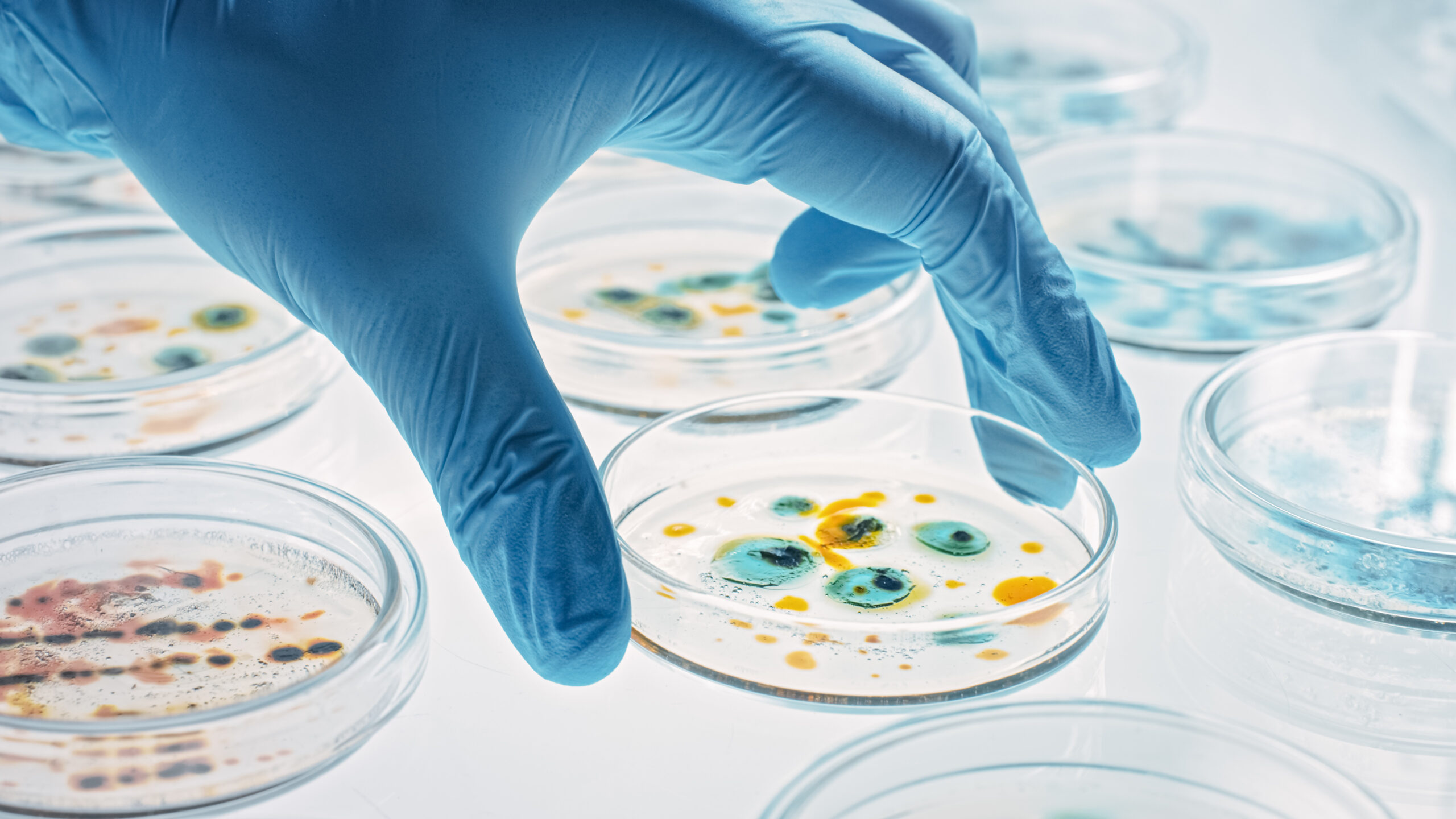Slowing the Spread of Antimicrobial Resistance